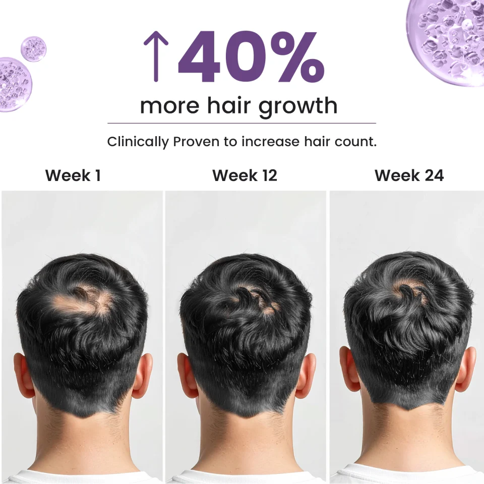 Neuherbs Hair Biotin Capsules - DHT Blocker Hair Supplement - Image 4